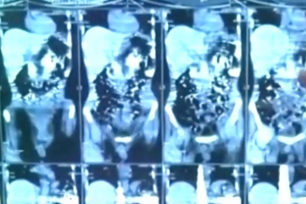 knives xray