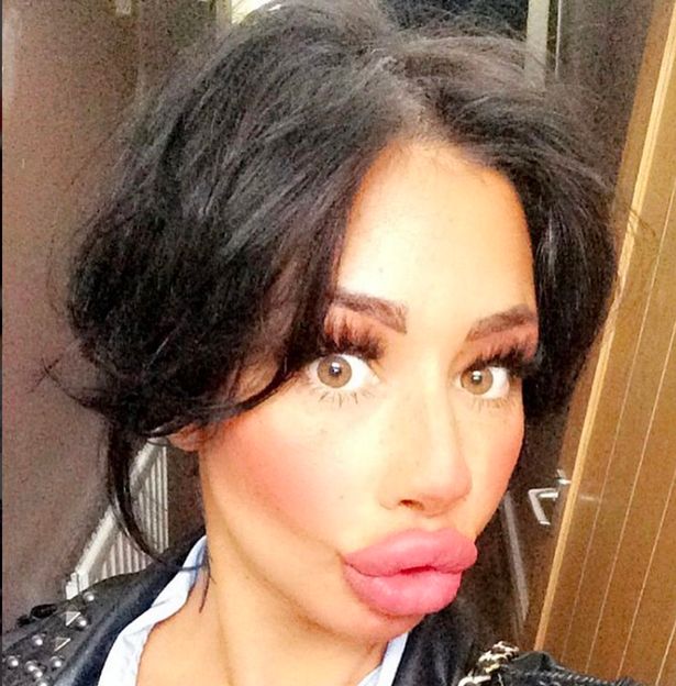 This Lady Whos Had £1600 Worth Of Lip Fillers Wants To Go Even Bigger 