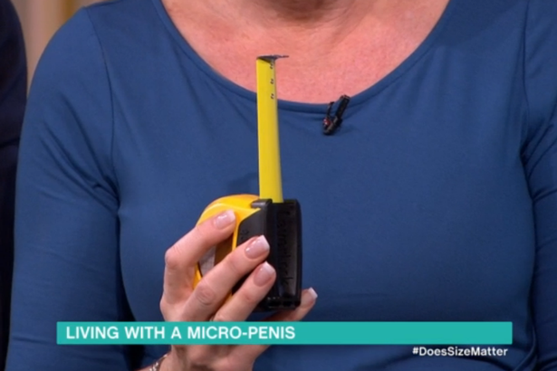 micropenis