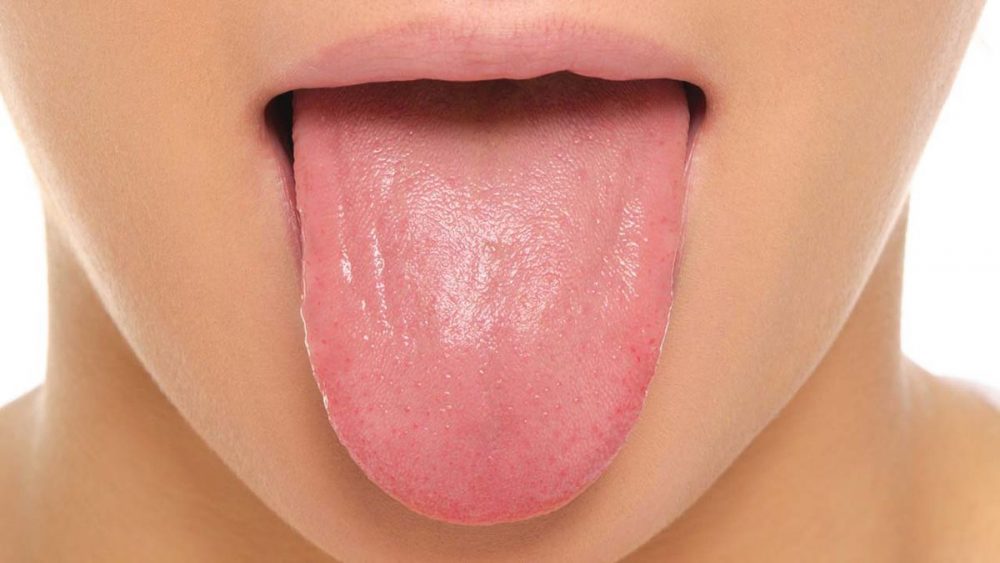 tongue