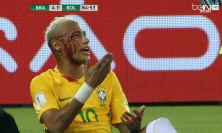 neymar-battered