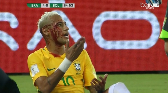 neymar-battered