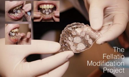 retainer