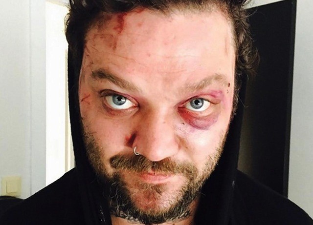 bam-margera