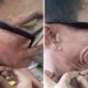 blackhead-pop