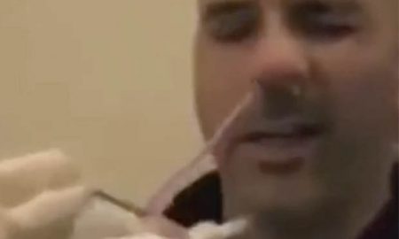 giant-tapeworm-nose