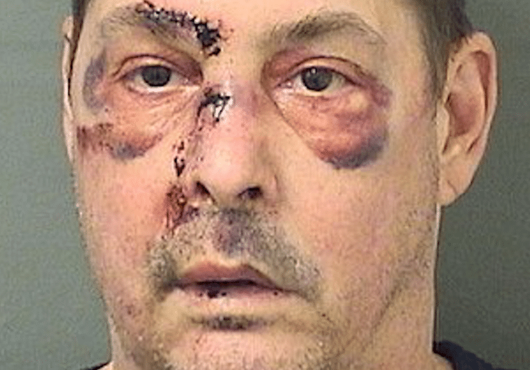 Naked Man Arrested For Trying To Seduce People With Wires On His Penis