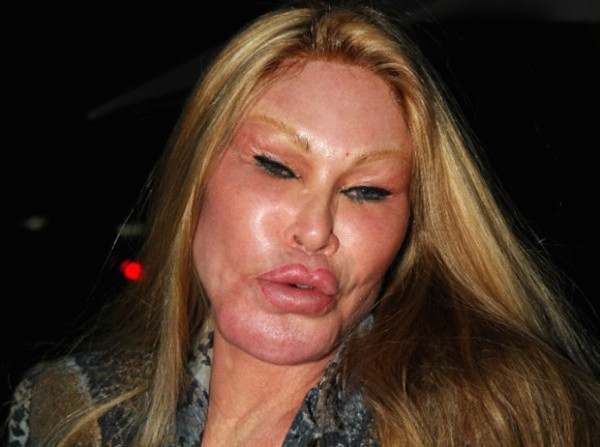 jocelyn-wildenstein