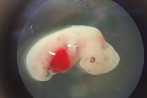 Embryo