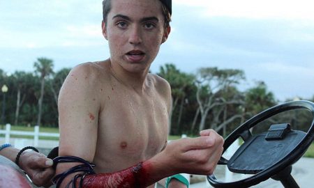 shark-bitten