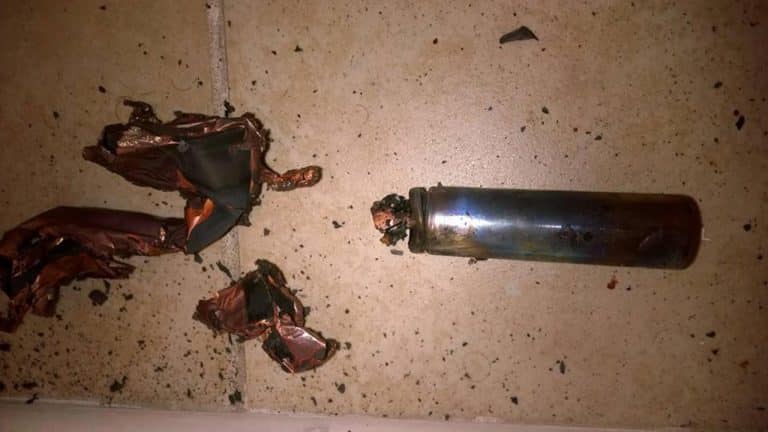 This Dude’s Vape Exploded In His Face And The Injuries Look Absolutely Horrific (NSFL)