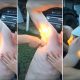 Armpit Hair Fire