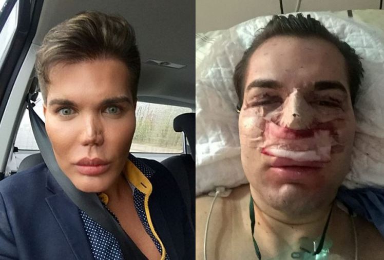 The ‘Human Ken Doll’ Close To Death After 50 Rounds Of