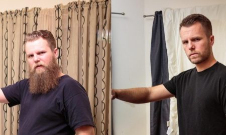 before after
