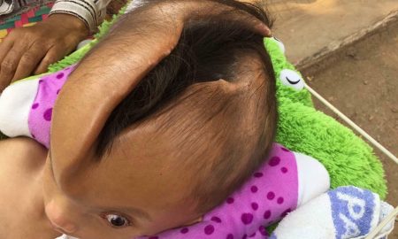 Head crack