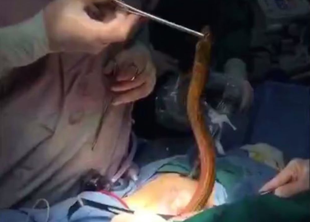 Eel Cut Out Stomach