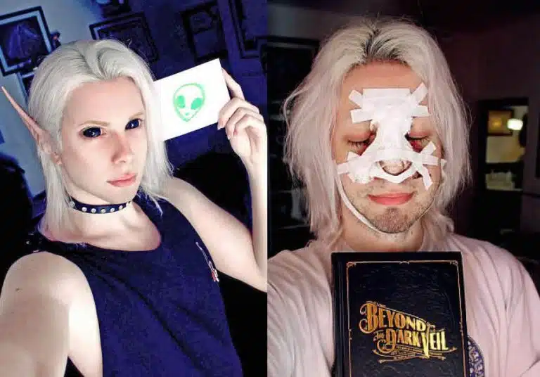 This Dude Spent Over £27K Transforming Himself Into A ‘Trans-Species’ Elf