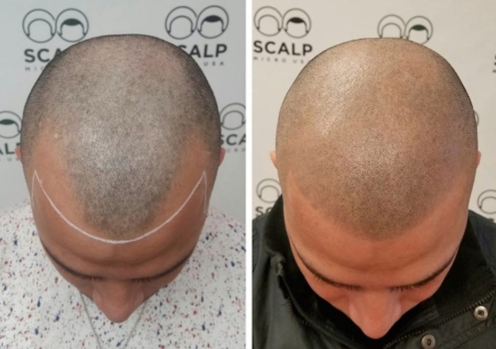 1. Bald Head Tattoo Designs for Men - wide 6