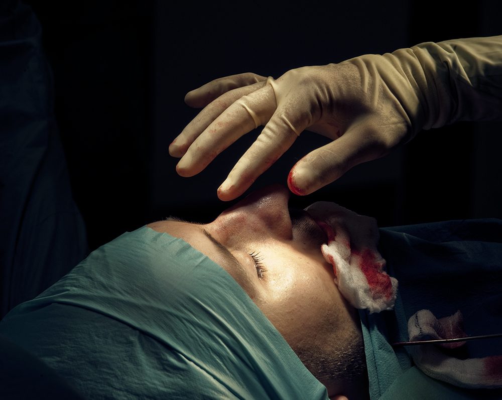 Cosmetic Surgery for Men: Male Vanity, the new Industry