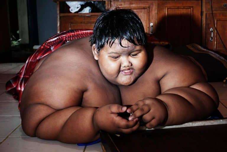 The World’s Fattest Kid Loses Five Stone After Life Changing Surgery