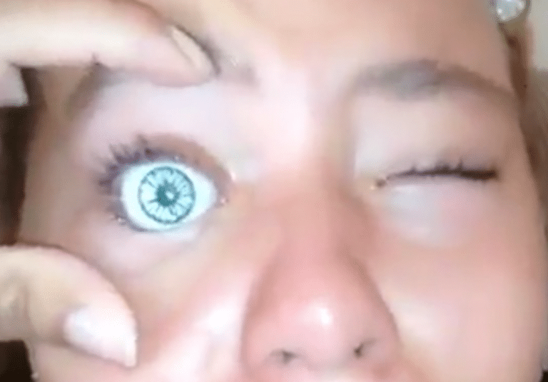 Glass Eye