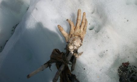 Hand