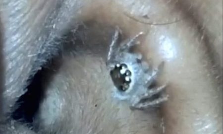 Spider ear