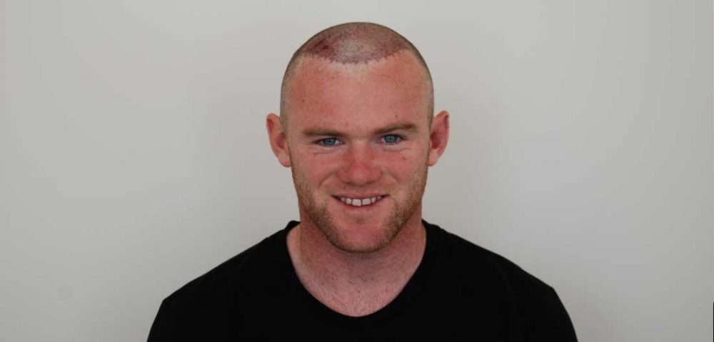 Wayne Rooney