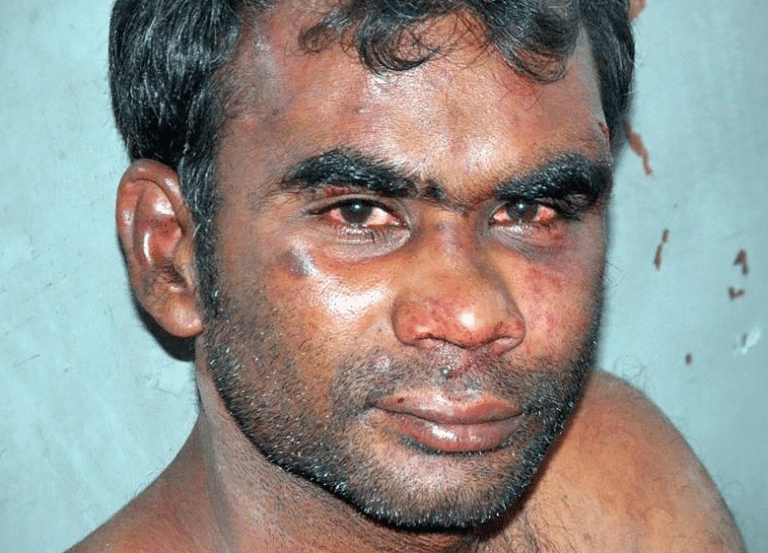 Son Murders Mum And Eats Her With Chutney After She Didn’t Give Him Beer Money
