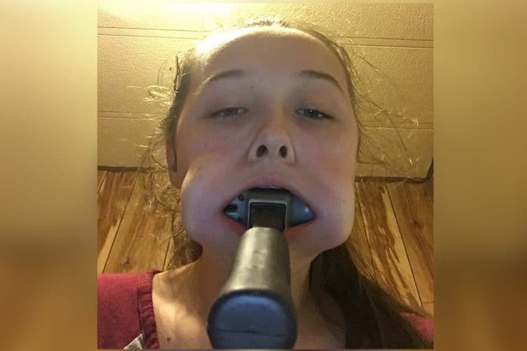 Teenager Accepts Dare To Fit A Hammer In Her Mouth; Instantly Regrets It