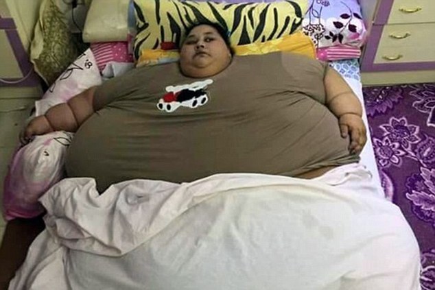 Fattest Woman
