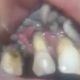 Maggot Teeth