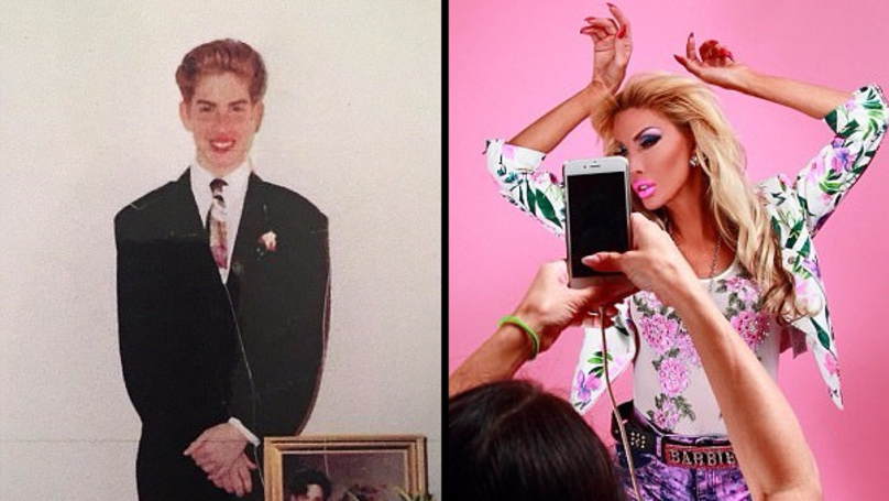 Transgender Woman Spends 1 Million To Look Like A Barbie Doll Sick Chirpse