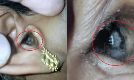 Spider In Ear