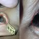 Spider In Ear