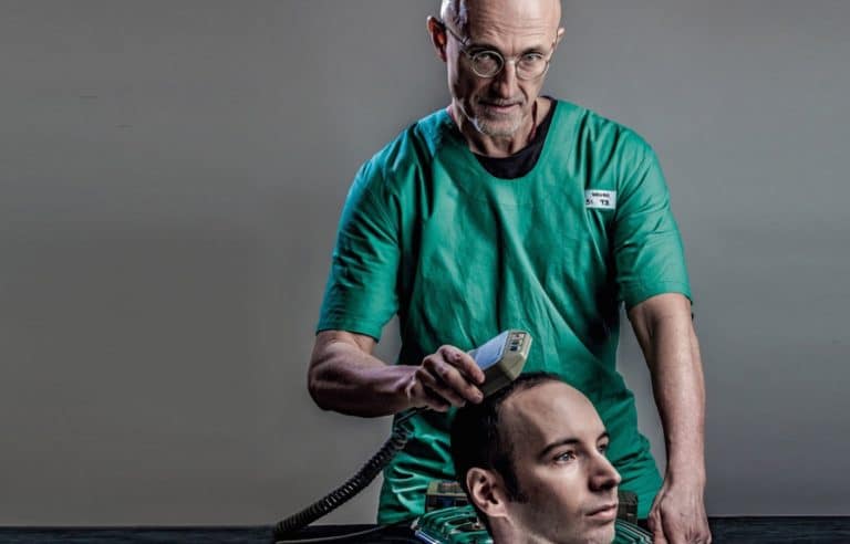 Human Head Transplant