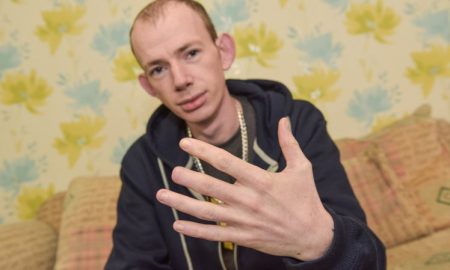 MAN LOSES FINGERTIP ON NIGHT OUT