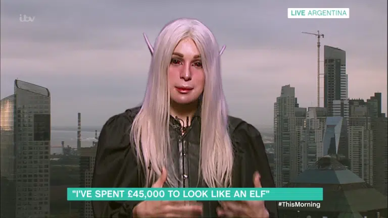 This Guy Spent £45,000 To Break His Jaw 5 Times And Become An Elf