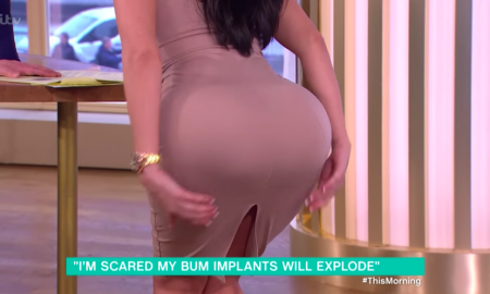 Butt Impant