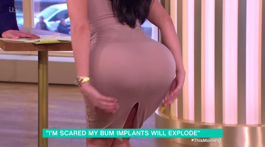 Butt Impant