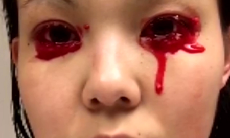 Bleeding Eyes