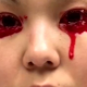 Bleeding Eyes
