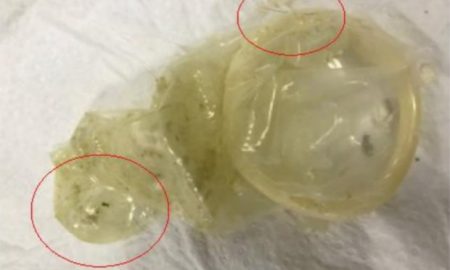 TESCO CUSTOMERS HORROR AT FINDING USED CONDOM WITH HAIRS ATTACHED TO IT' IN PACKET OF KALE.