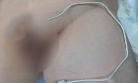 Curious Teen Inserts Phone Cable Into Penis