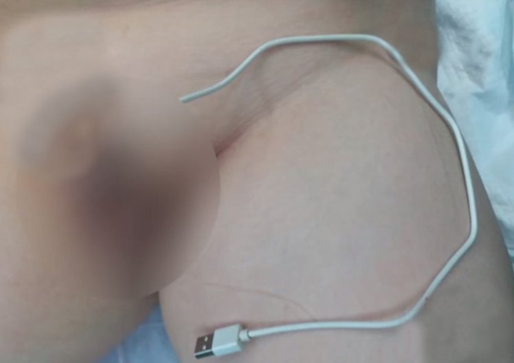 Curious Teen Inserts Phone Cable Into Penis