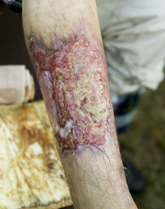 Krokodil 2