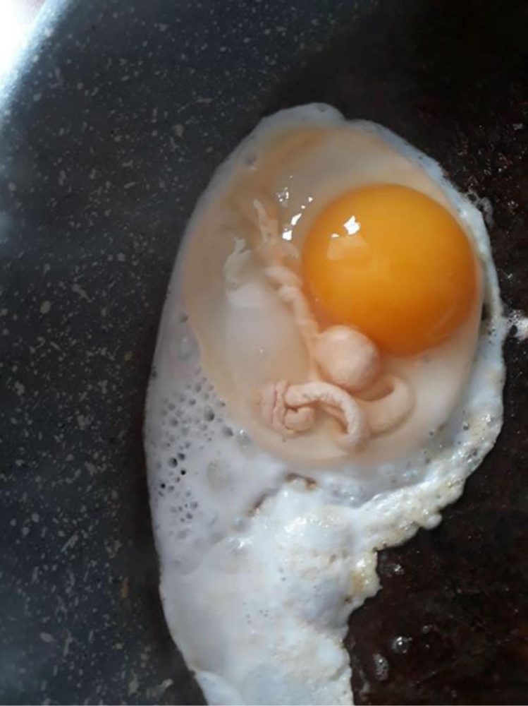 Embryo 2