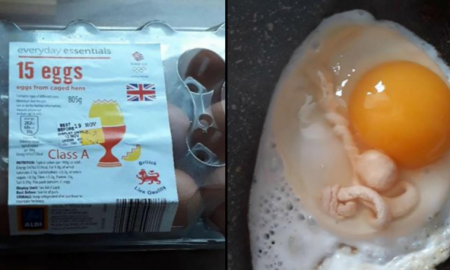 Embryo