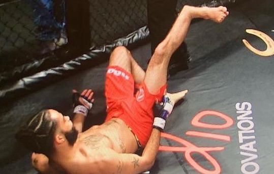 MMA Leg Break