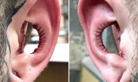 Hole Ears